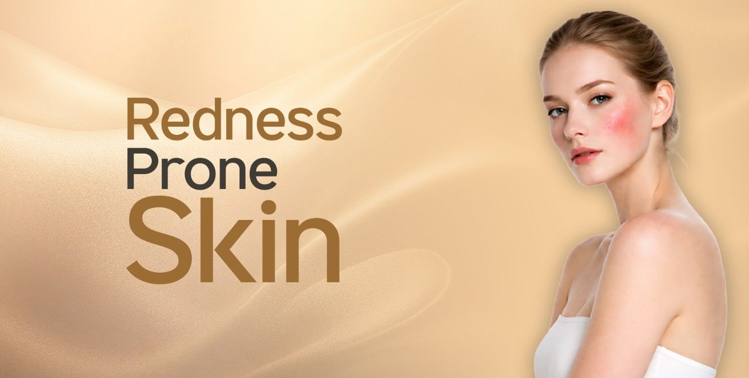 Woman with visible redness on her cheeks, representing the Redness-Prone Skin collection.