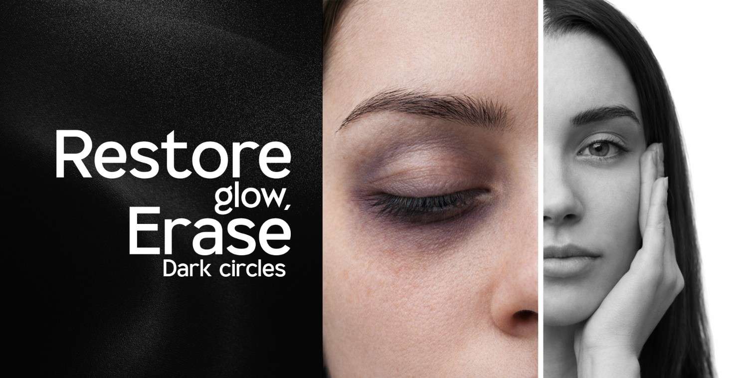 Dark Circles