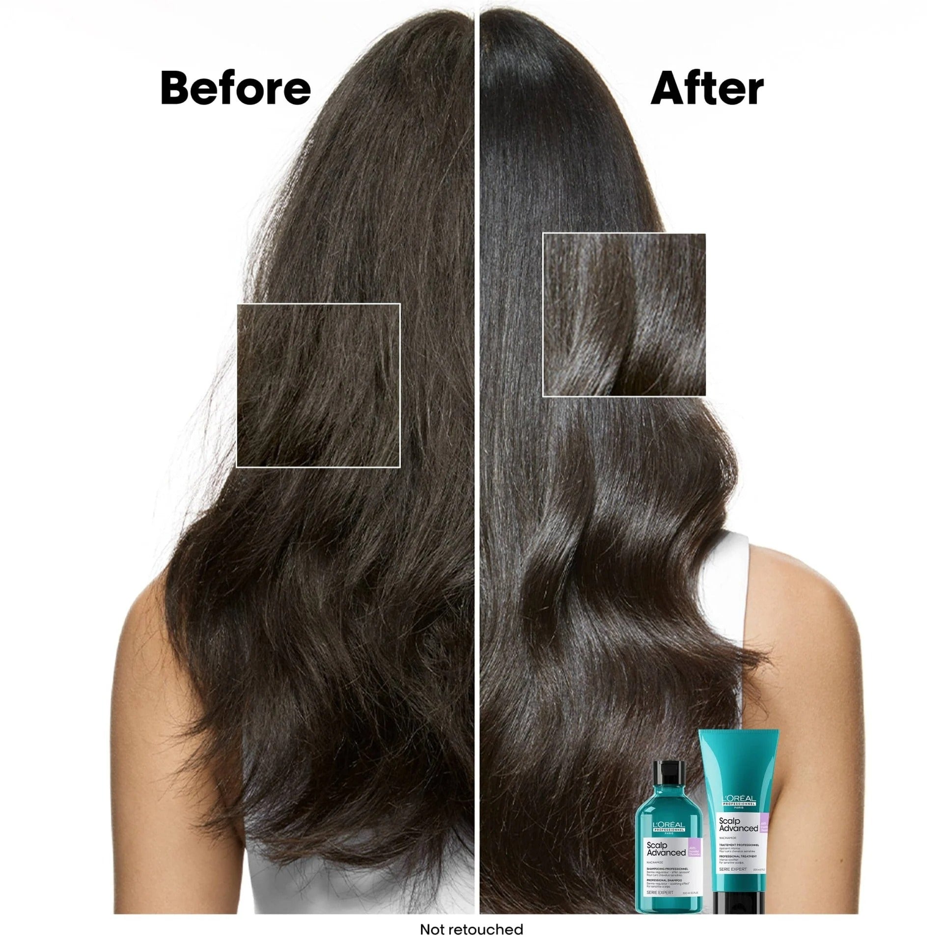 L'Oréal Professionnel Scalp Advanced Professional Shampoo Refill 500ml