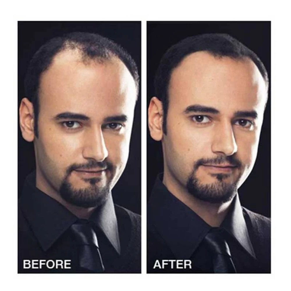 Toppik Hair Fiber 12g-All-Aladin Beauty