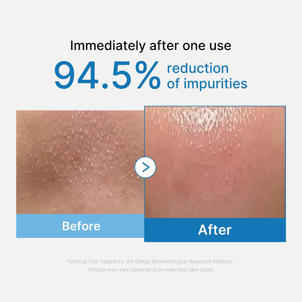 Medicube Pore Blackhead Deep Cleansing Oil 205ml